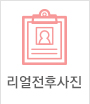 리얼전후사진
